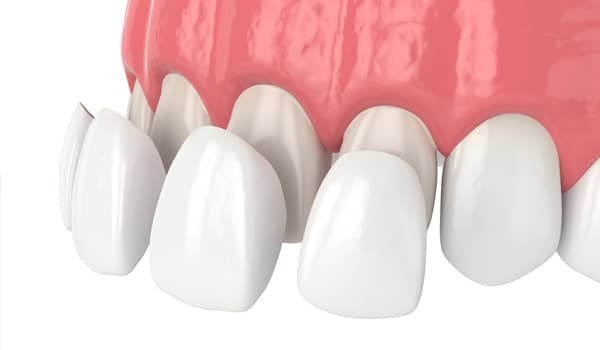 Treatment - Purlys Dental Practice