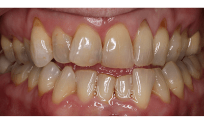 Before - Purlys Dental Practice