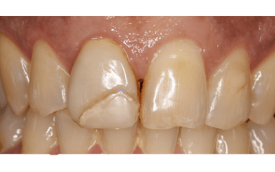 Before - Purlys Dental Practice